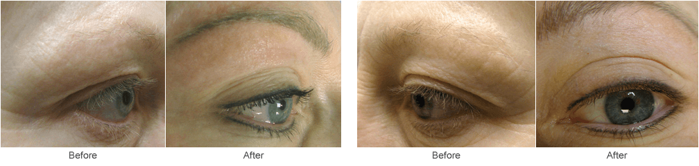 Eyeliner & Eyebrow Tattooing: Permanement Cosmetics in St. Louis